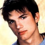 Ashton Kutcher plastic surgery (13)