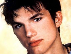 Ashton Kutcher plastic surgery (13)