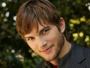 Ashton Kutcher plastic surgery (14)