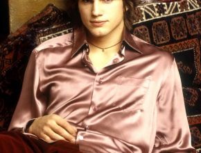 Ashton Kutcher plastic surgery (16)