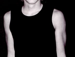 Ashton Kutcher plastic surgery (17)