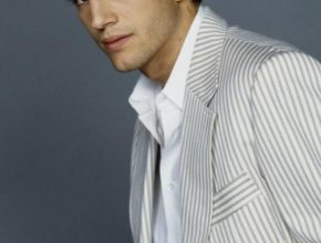 Ashton Kutcher plastic surgery (24)