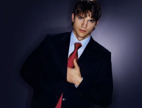 Ashton Kutcher plastic surgery (25)
