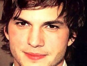 Ashton Kutcher plastic surgery (26)
