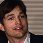 Ashton Kutcher plastic surgery (39)