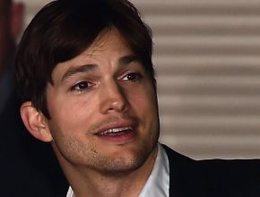 Ashton Kutcher plastic surgery (39)