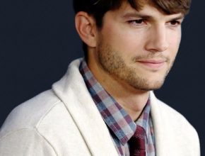 Ashton Kutcher plastic surgery (41)