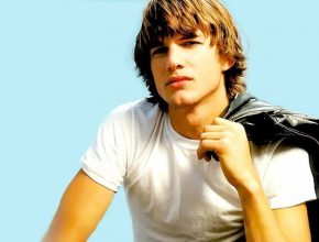 Ashton Kutcher plastic surgery (43)
