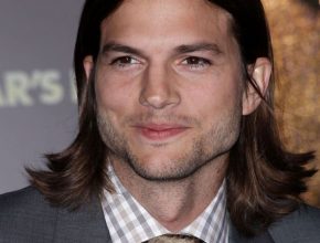 Ashton Kutcher plastic surgery (45)
