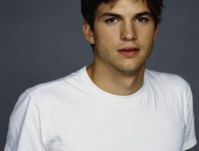 Ashton Kutcher plastic surgery (9)