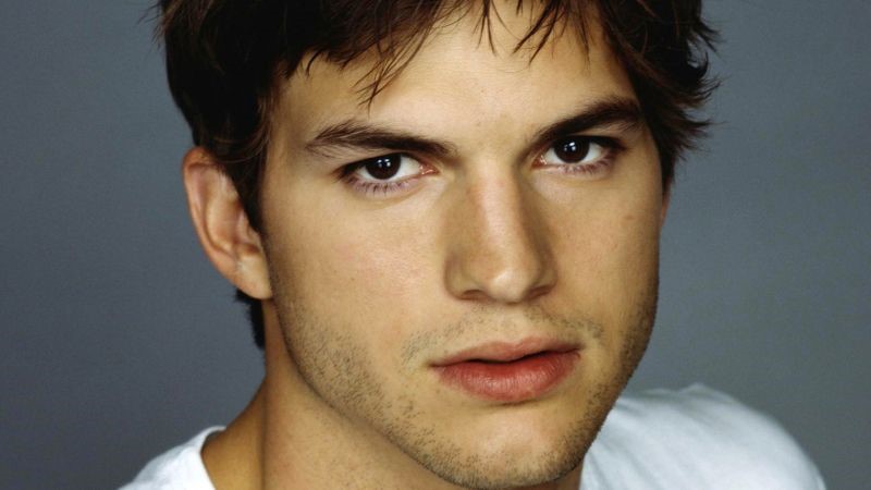 Ashton Kutcher plastic surgery