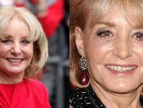 Barbara Walters before and after plastic surgery (11)