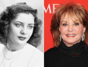 Barbara Walters before and after plastic surgery
