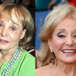 Barbara Walters before and after plastic surgery (30)