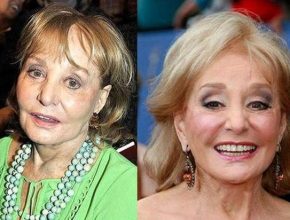 Barbara Walters before and after plastic surgery (30)