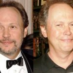 Billy Crystal before and after plastic surgery (1)