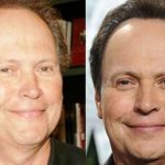 Billy Crystal before and after plastic surgery (2)