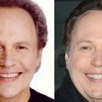 Billy Crystal before and after plastic surgery (29)