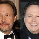 Billy Crystal before and after plastic surgery (30)