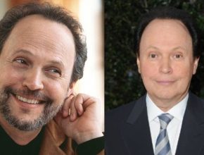 Billy Crystal before and after plastic surgery