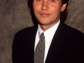 Billy Crystal plastic surgery (24)