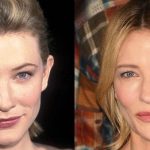 Cate Blanchett before and after plastic surgery (01)