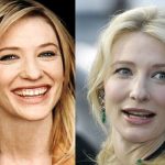 Cate Blanchett before and after plastic surgery (26)