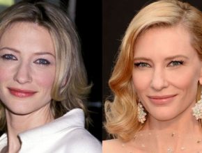Cate Blanchett before and after plastic surgery