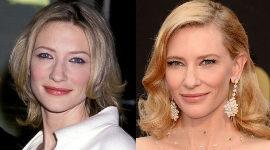 Cate Blanchett before and after plastic surgery
