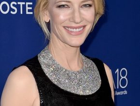 Cate Blanchett plastic surgery (16)