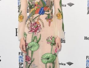 Cate Blanchett plastic surgery (28)