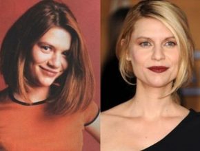 Claire Danes before and after plastic surgery (29)