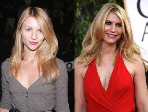 Claire Danes before and after plastic surgery (31)