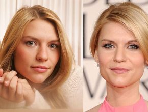 Claire Danes before and after plastic surgery