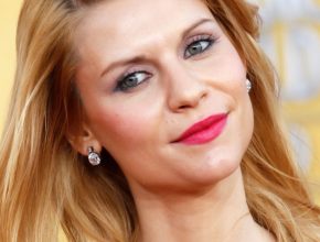 Claire Danes plastic surgery (21)