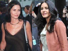 Courteney Cox before and after plastic surgery ()