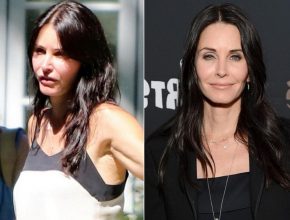 Courteney Cox before and after plastic surgery (17)