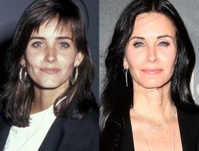 Courteney Cox before and after plastic surgery (32)