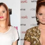 Debby Ryan before and after plastic surgery 01