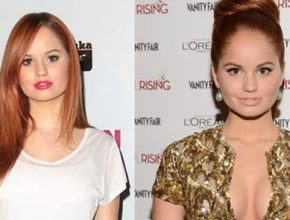 Debby Ryan before and after plastic surgery 01