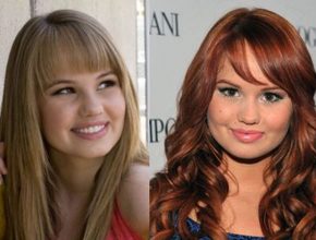 Debby Ryan before and after plastic surgery