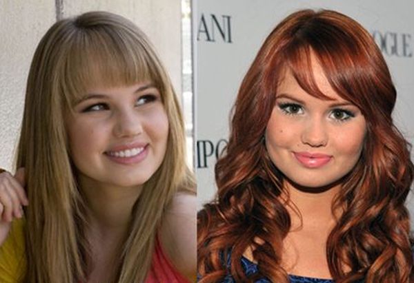 Debby Ryan before and after plastic surgery