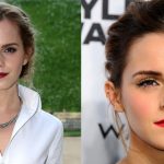 Emma Watson before and after plastic surgery (00)