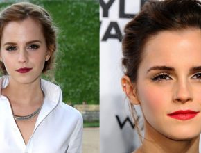 Emma Watson before and after plastic surgery (00)