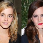 Emma Watson before and after plastic surgery (16)