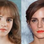 Emma Watson before and after plastic surgery (17)