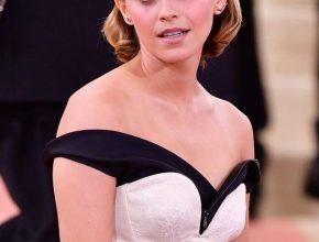 Emma Watson plastic surgery (25)