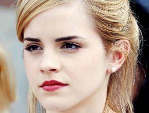 Emma Watson plastic surgery (38)
