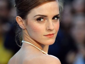 Emma Watson plastic surgery (41)