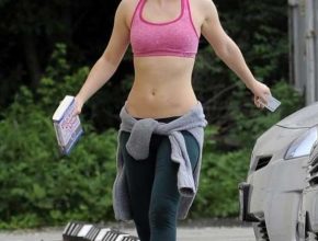 Emma Watson plastic surgery (44)